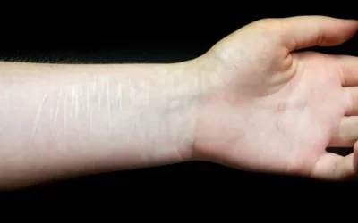 March is Self-Harm Awareness Month